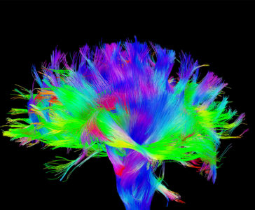 MRI brain scan graphic
